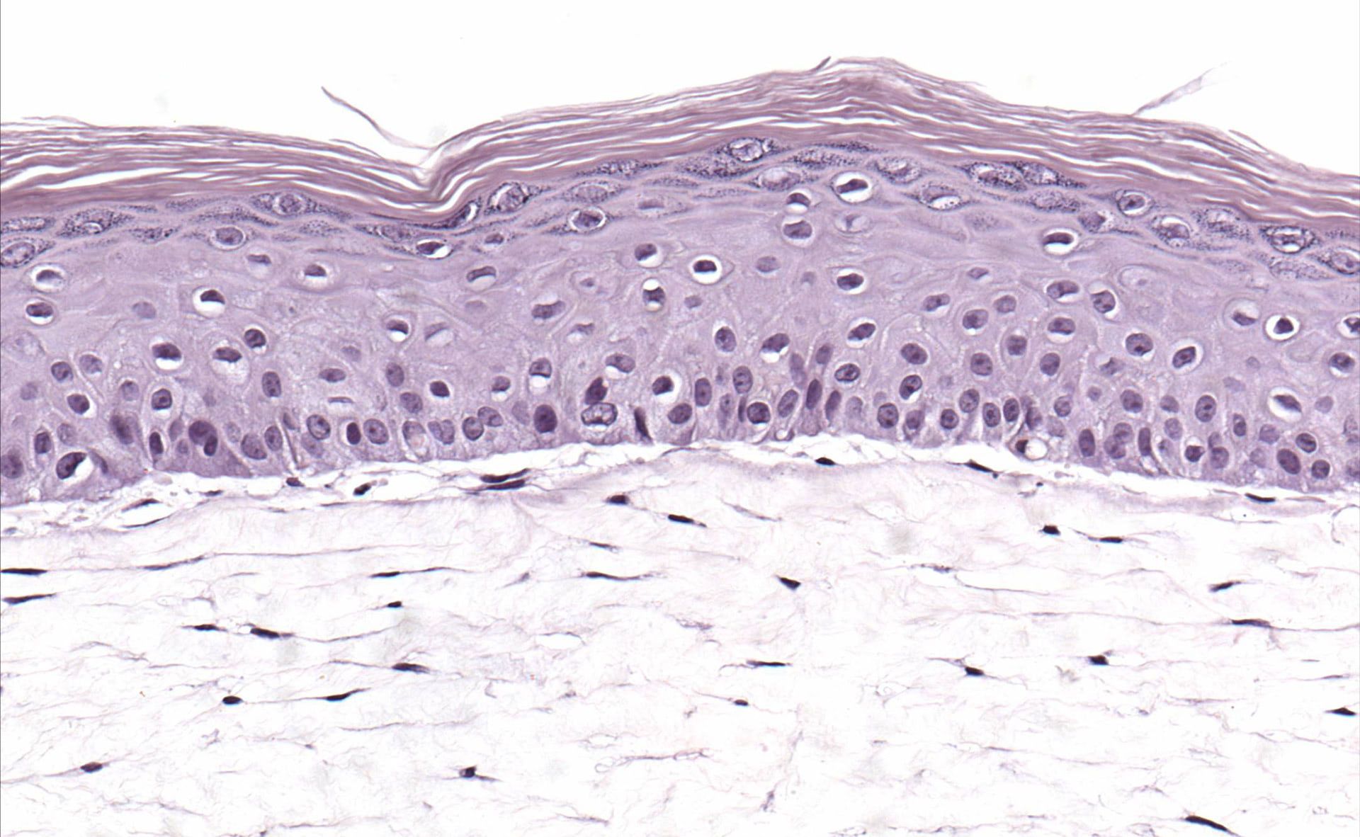 in vitro human skin