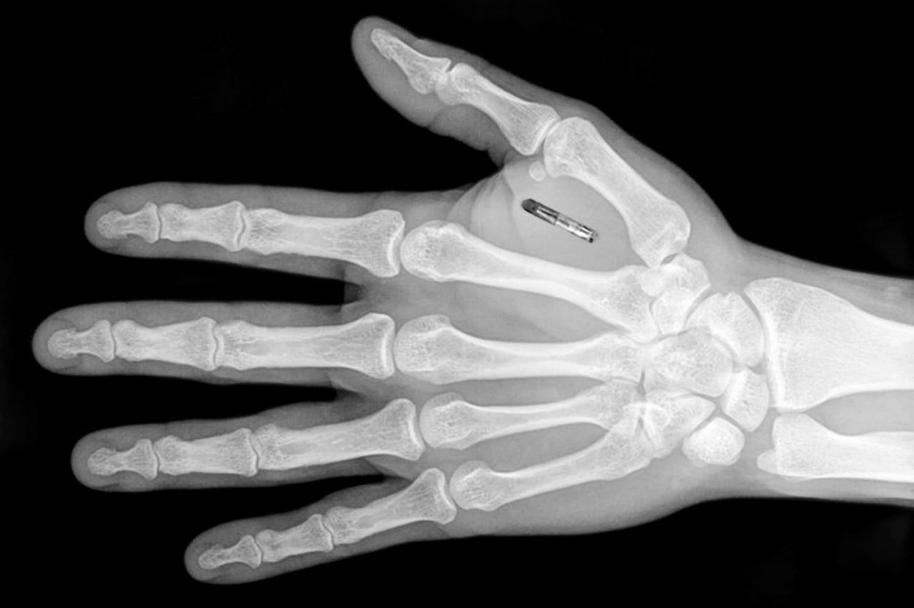 Visual of Implanting Chips into Employees