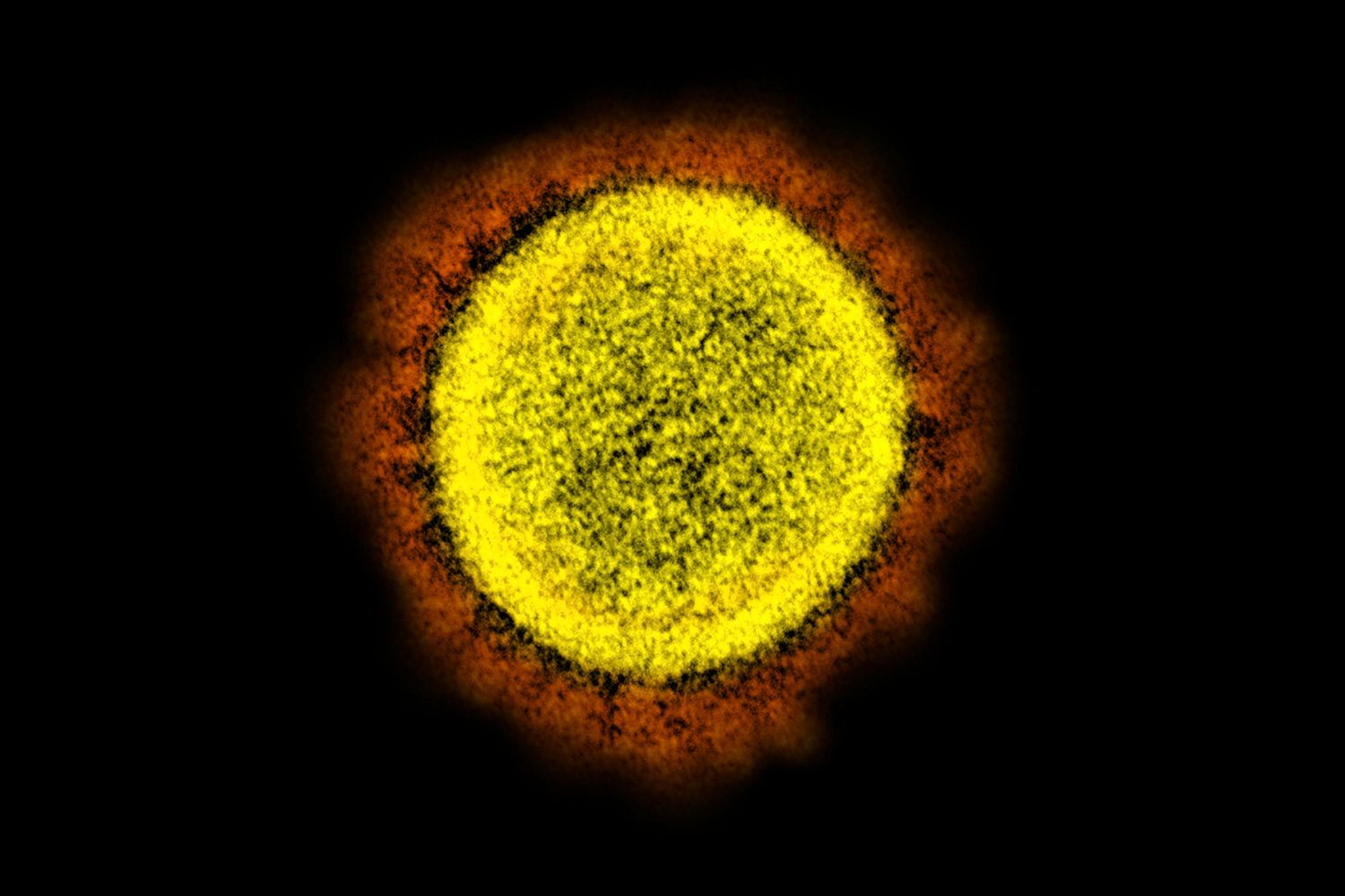 Lab or nature: scientists are debating the origins of COVID-19