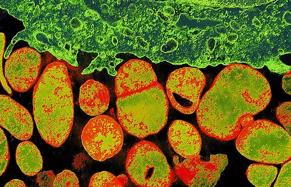 Complete Computer Simulation of a Bacterium Holds Hope for Medicine