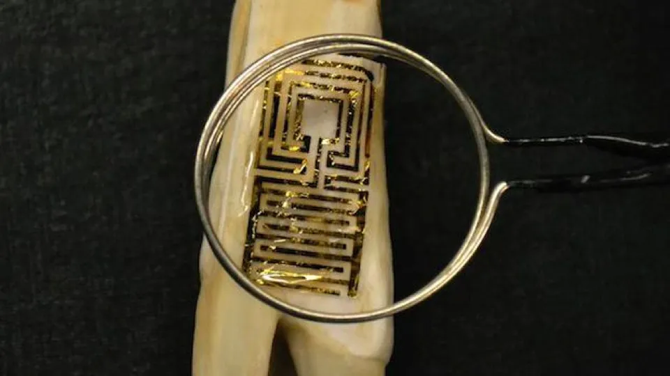 Twitter Implant becomes a Reality