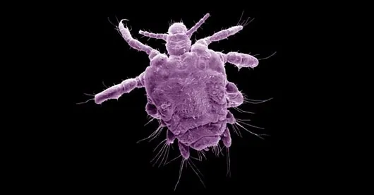 Pubic Lice (Possibly) Going Extinct Due to Brazilian Waxing