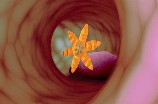 Medical Microbots Used to Perform Biopsy