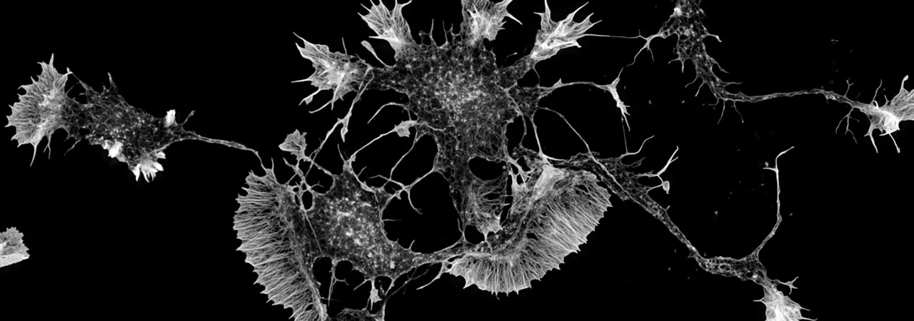 A Step Further in the Race Against AI