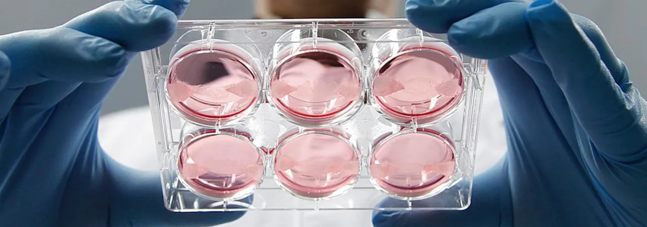 Towards a Post-Animal Bioeconomy