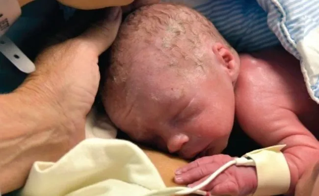 2014 - Womb Transplant Baby Born