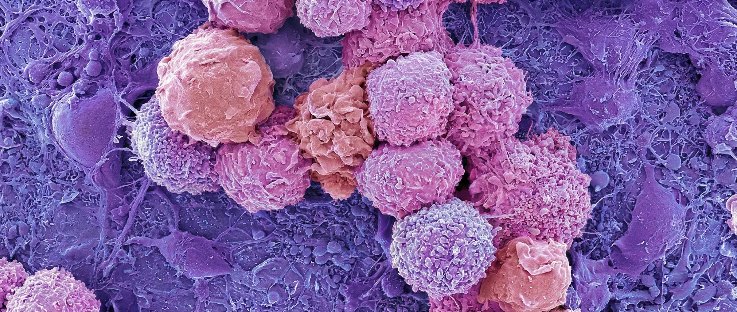 Computers made of brain cells: science fiction or reality?